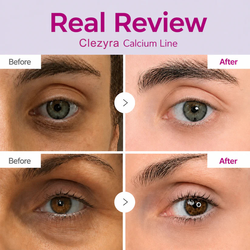 🔥LAST DAY 50% OFF!!Clezyra  Korean Calcium Dark Spot Eye Cream